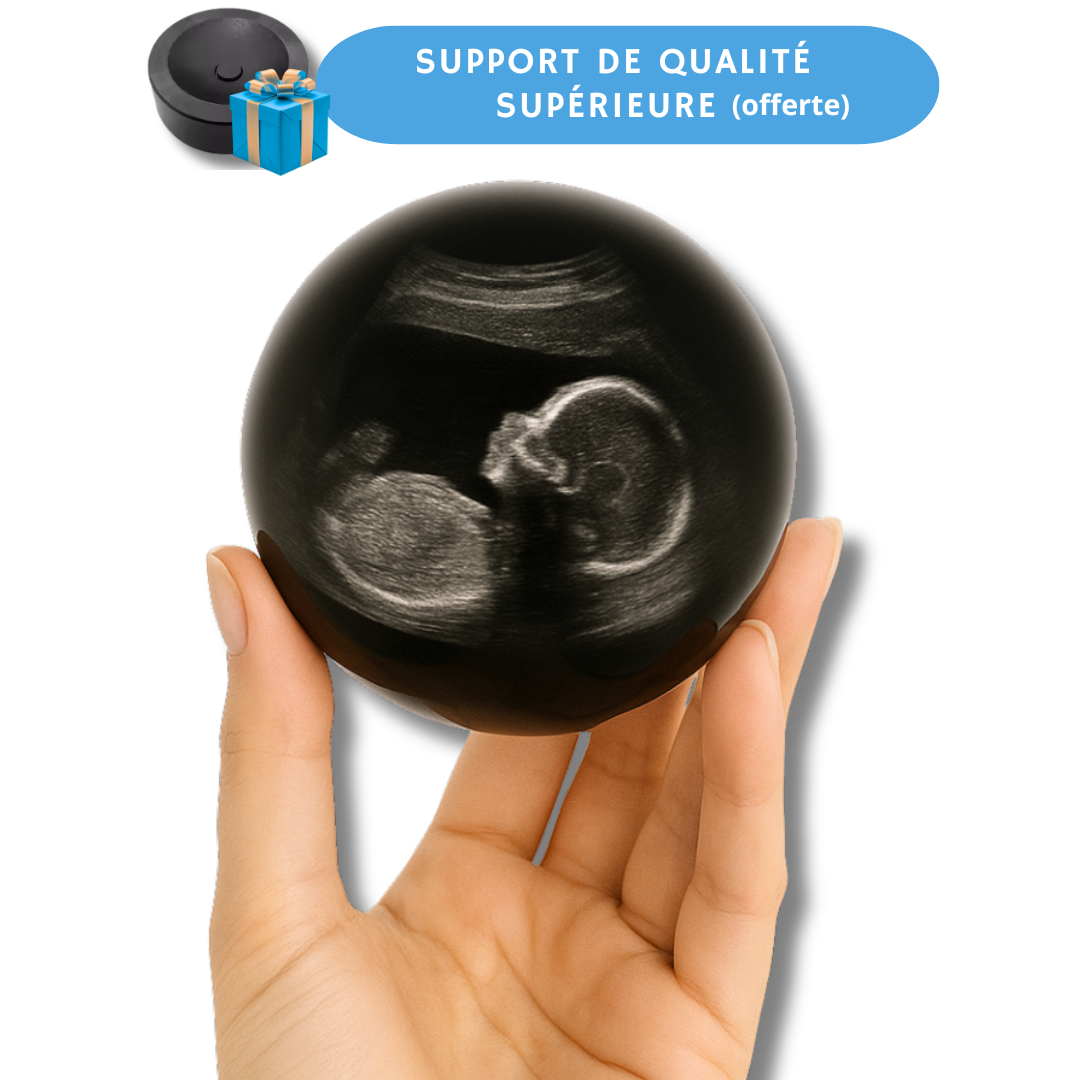 Technologie Avancée du Souvenir